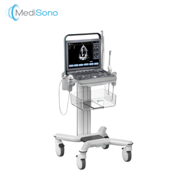 Portable Colour Doppler Ultrasound System - P11 Plus